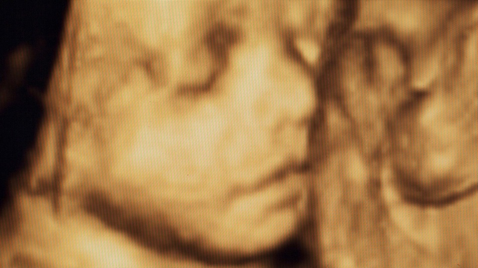 В Австралії вагітні замість ультразвукових фотографій дитини отримували фейки, знайдені в Google