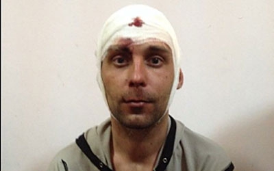 Під час сутичок у Донецьку постраждав кореспондент «Дзеркала тижня» Євген Шибалов