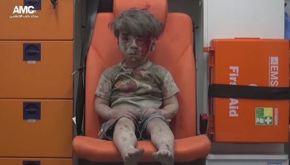 Фото хлопчика, який вижив після авіаудару, стало символом війни в Сирії