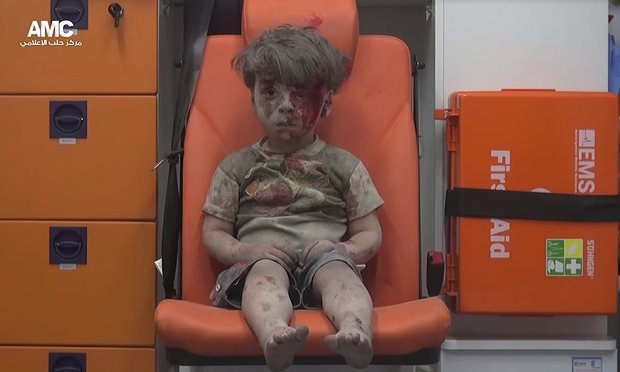 Фото хлопчика, який вижив після авіаудару, стало символом війни в Сирії