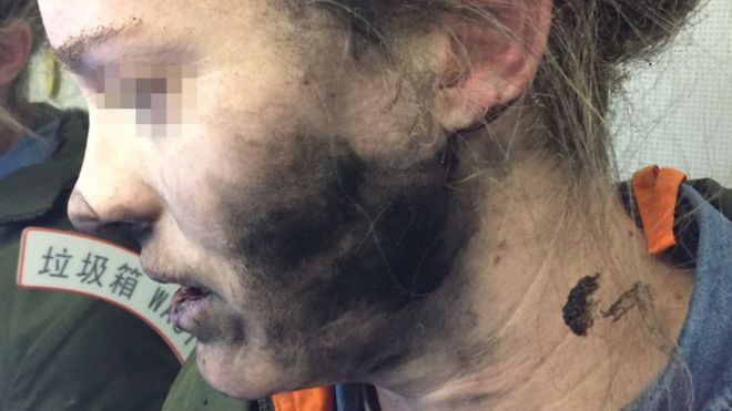 У жінки в літаку вибухнули навушники від мобільного
