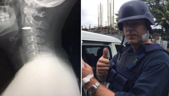 Журналіста ABC поранили в шию під час зйомки на Філіппінах