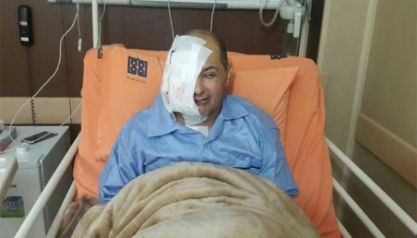Іранський журналіст втратив око через відсутність лікування у в’язниці