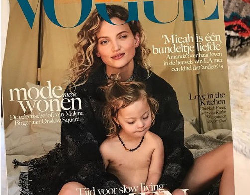 Нідерландський Vogue вперше опублікував фото дитини з синдромом Дауна на обкладинці