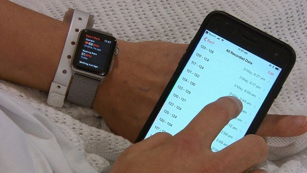Завдяки Apple Watch австралієць виявив серйозні проблеми з серцем