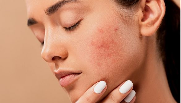 Коронавірус може призвести до довготривалих проблем зі шкірою — дослідження