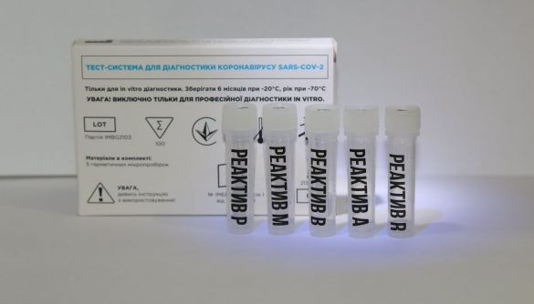 Українські науковці розробили тест, який дозволяє одночасно визначати COVID-19 та два штами грипу