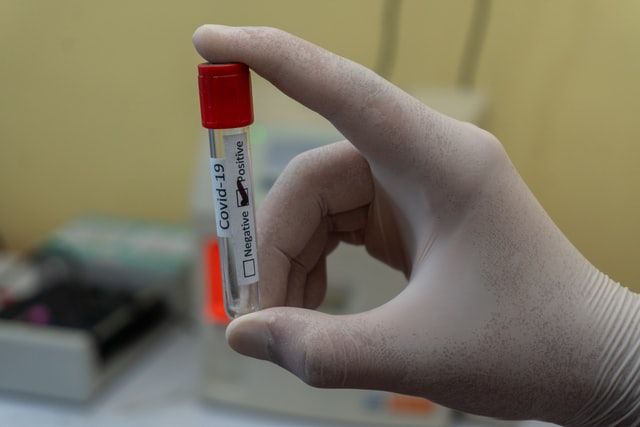 Дві третини українців вважають, що вакцинація від COVID-19 потрібна всім — дослідження