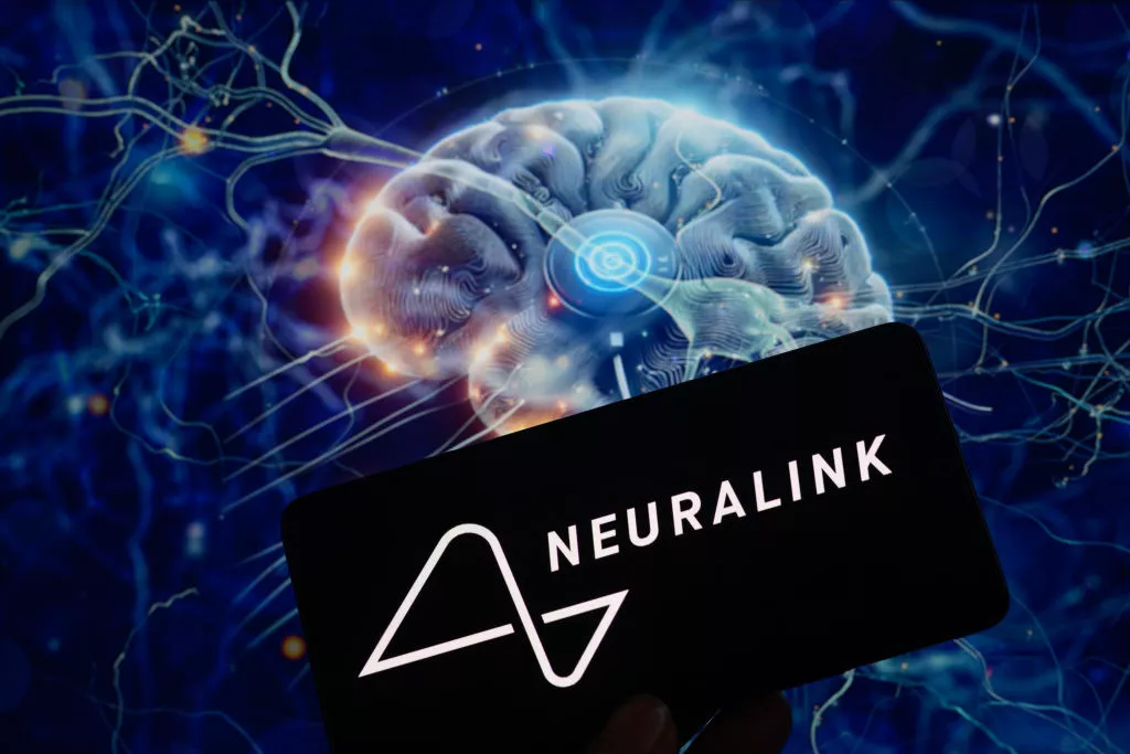 Ілон Маск заявив, що перша людина з імплантом Neuralink почала керувати комп'ютерною мишею силою думки